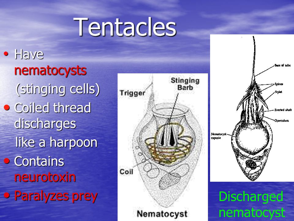 Tentacles Have nematocysts (stinging cells) Coiled thread discharges