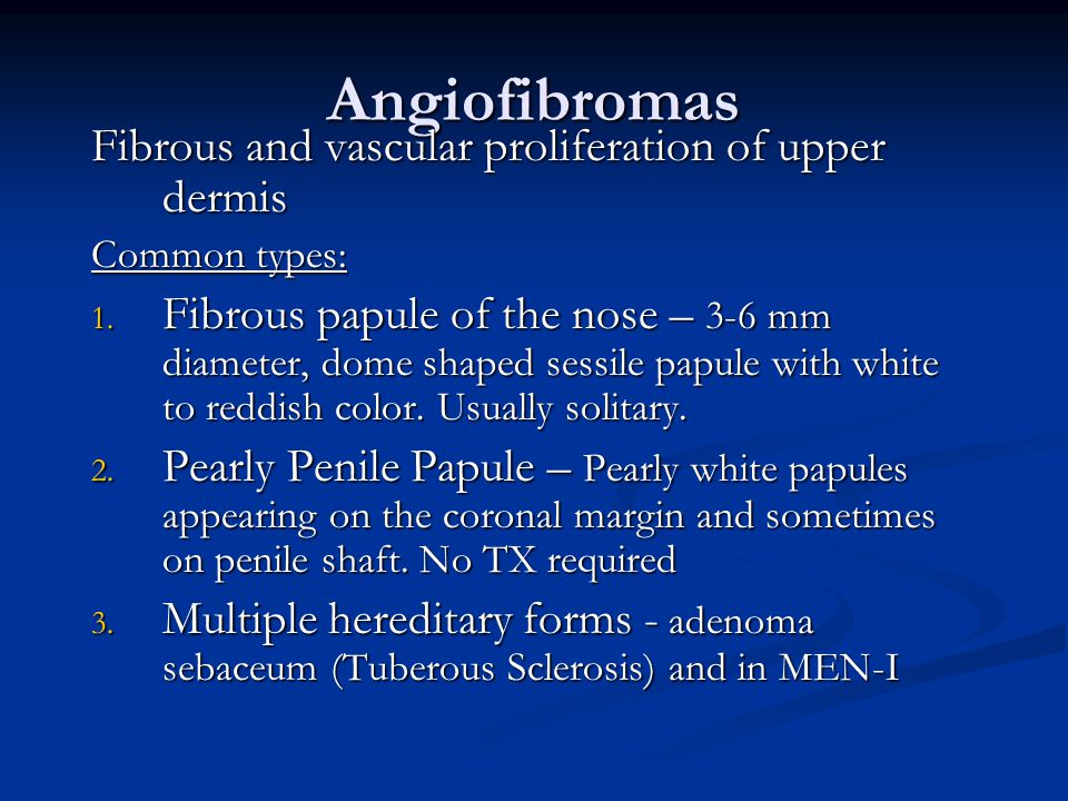 Angiofibromas Fibrous and vascular proliferation of upper dermis