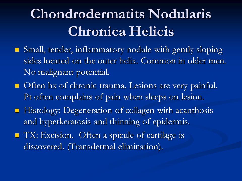 Chondrodermatits Nodularis Chronica Helicis