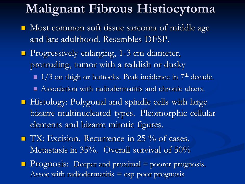 Malignant Fibrous Histiocytoma