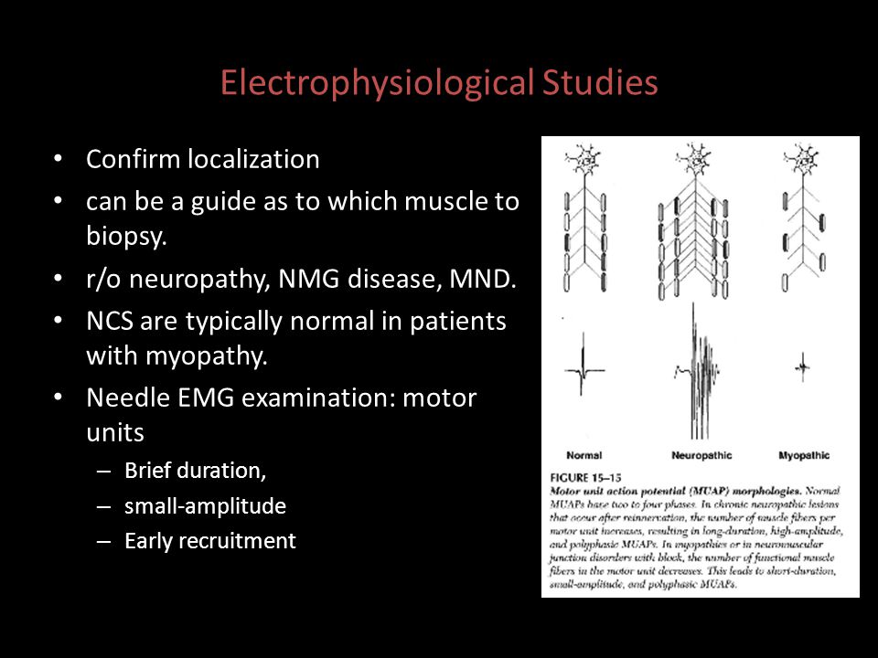 Electrophysiological Studies