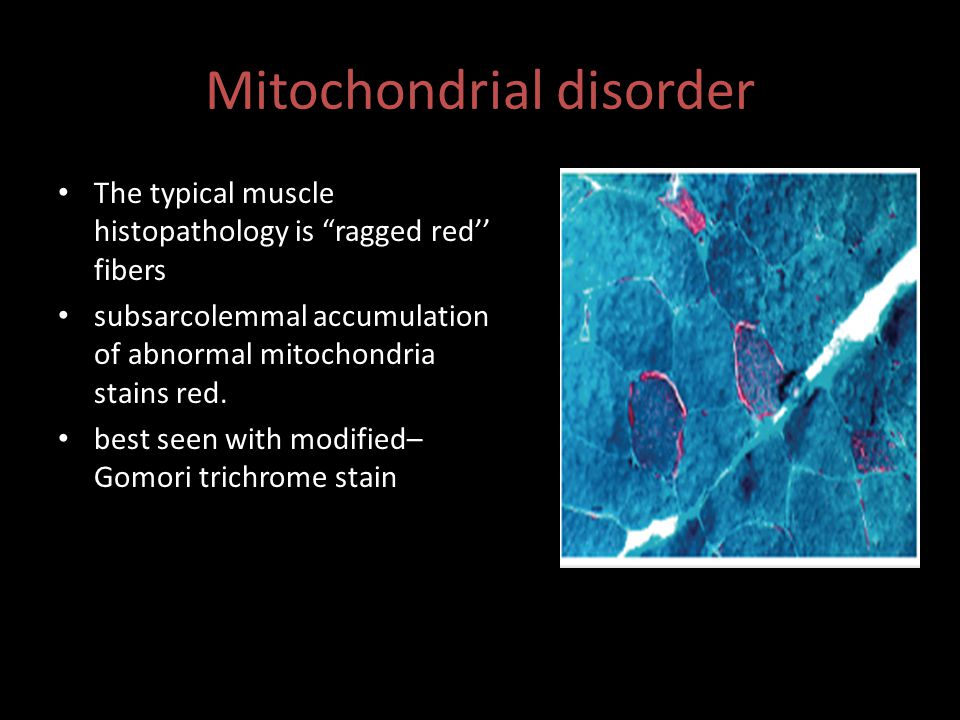 Mitochondrial disorder