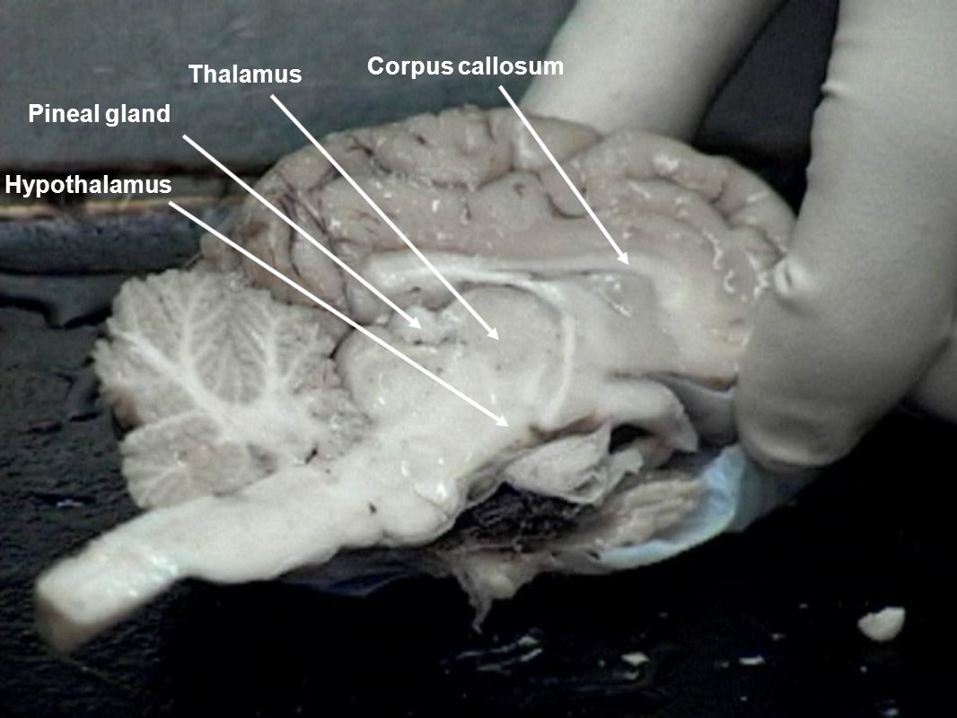 Corpus callosum Thalamus Pineal gland Hypothalamus