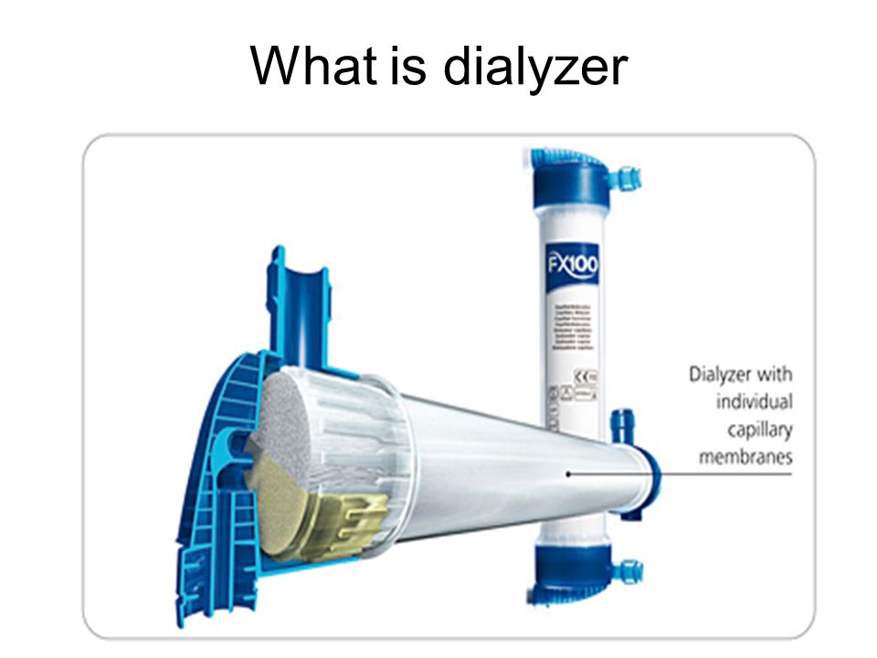 What is dialyzer
