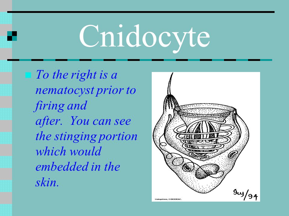 Cnidocyte To the right is a nematocyst prior to firing and after. You can see the stinging portion which would embedded in the skin.