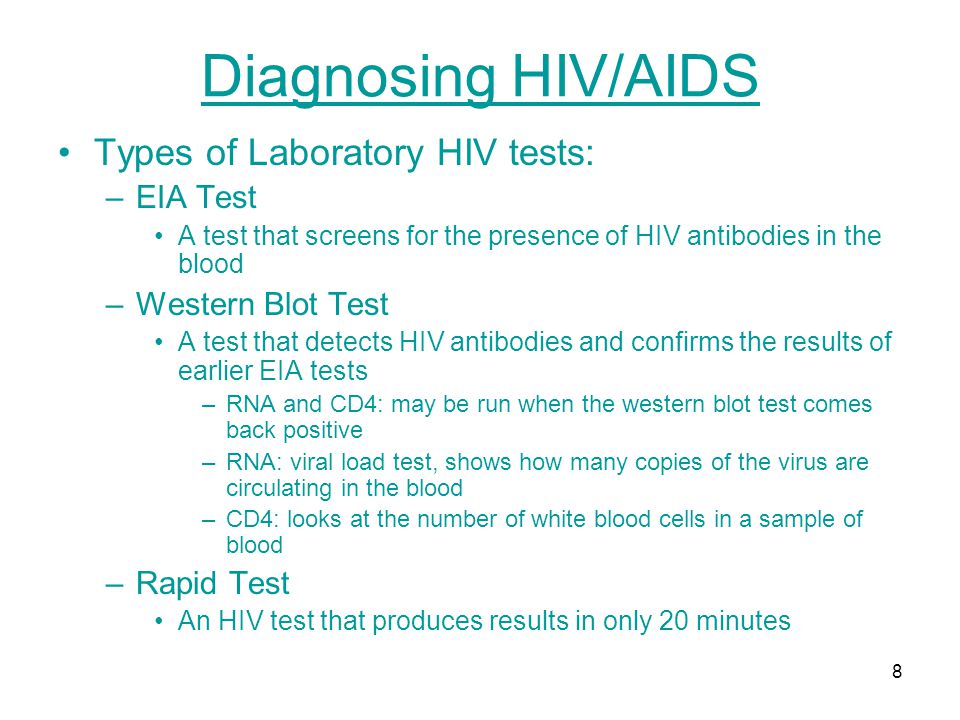Diagnosing HIV/AIDS Types of Laboratory HIV tests: EIA Test
