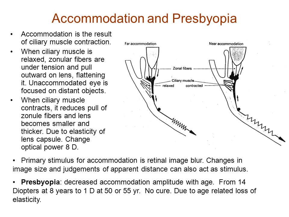 Accommodation and Presbyopia