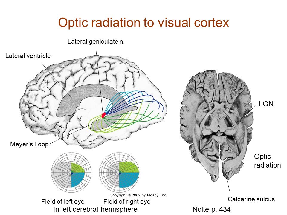 Optic radiation to visual cortex
