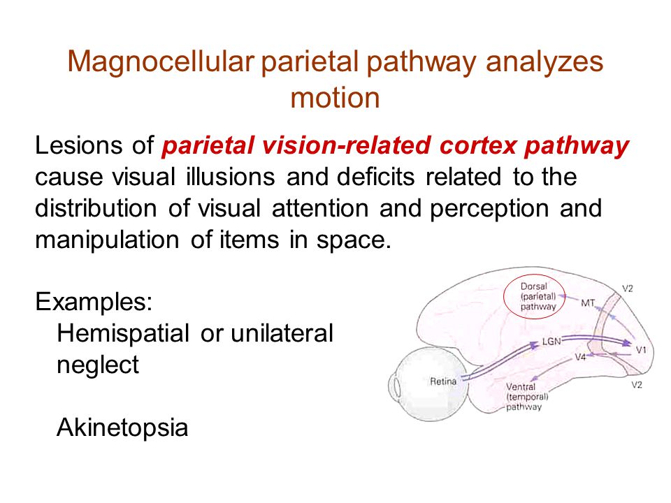 Magnocellular parietal pathway analyzes motion