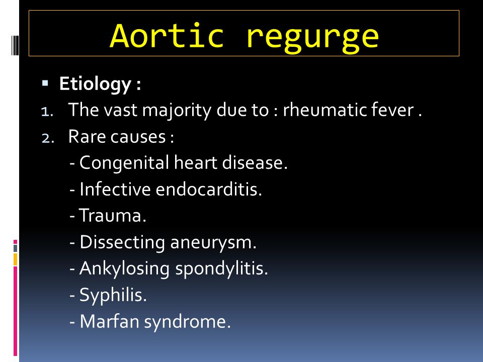 Aortic regurge Etiology : The vast majority due to : rheumatic fever .