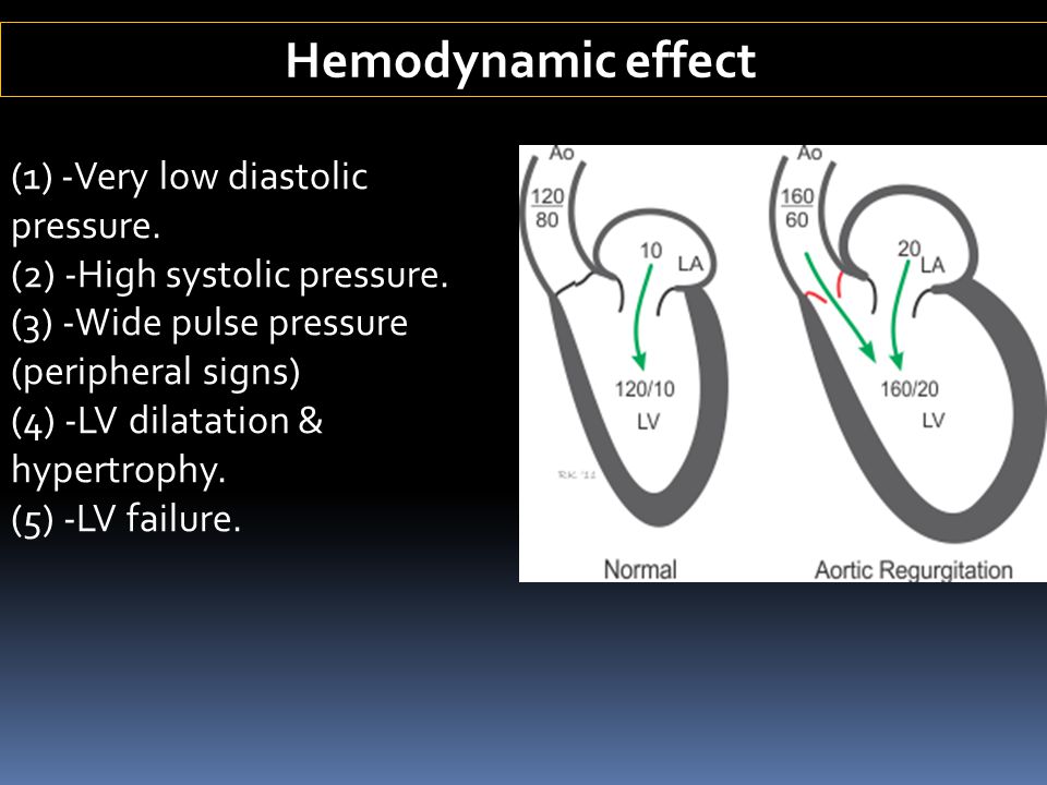 Hemodynamic effect (1) -Very low diastolic pressure.