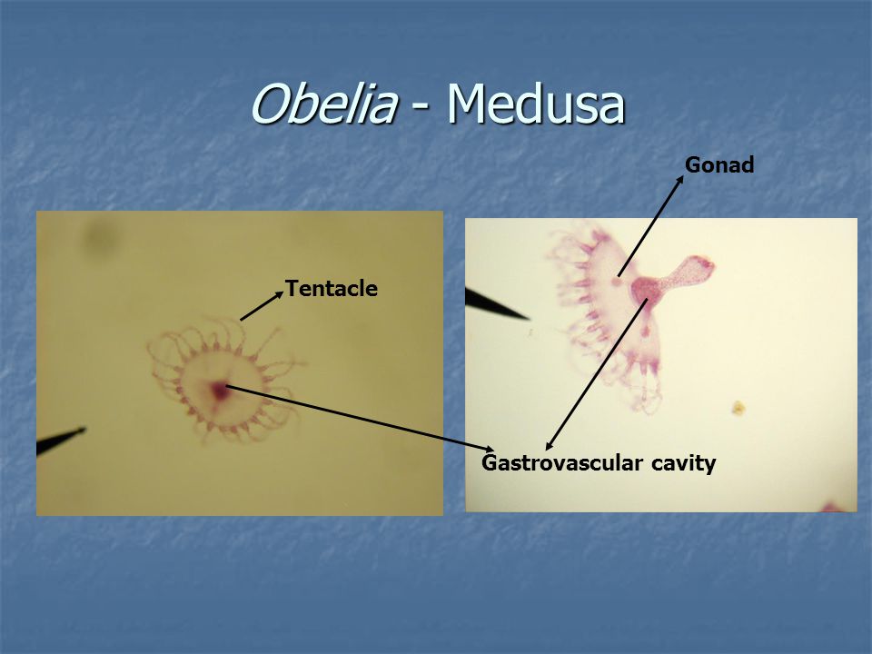 Obelia - Medusa Gonad Tentacle Gastrovascular cavity