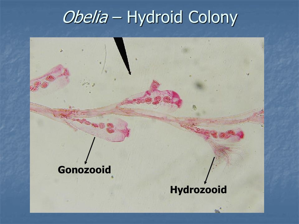 Obelia – Hydroid Colony