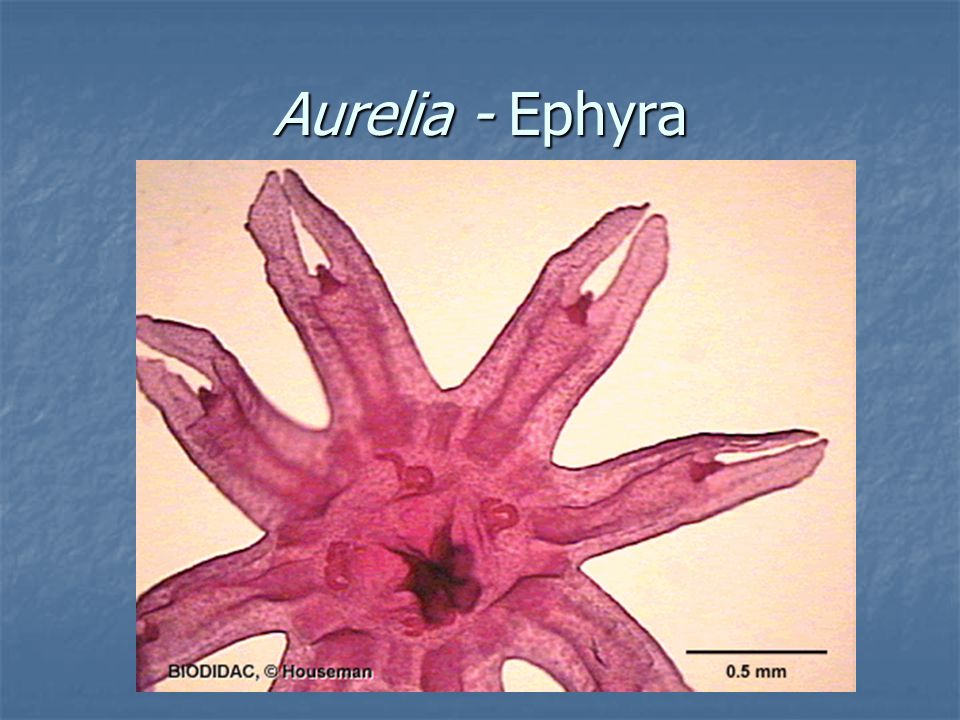 Aurelia - Ephyra
