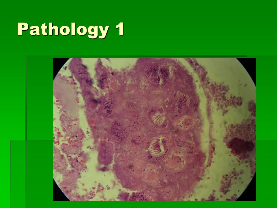 Pathology 1