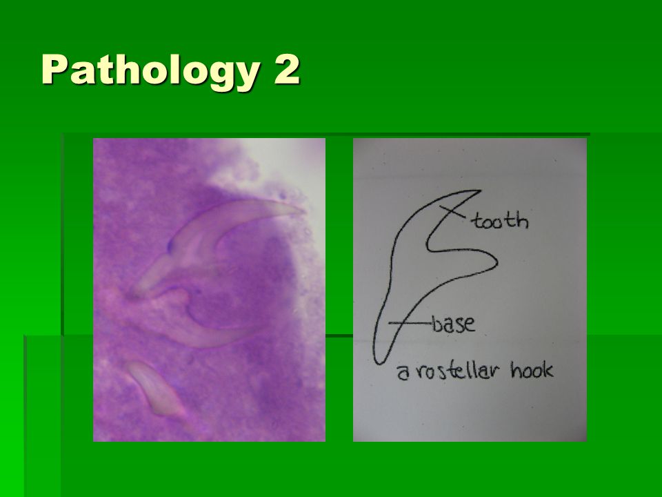 Pathology 2