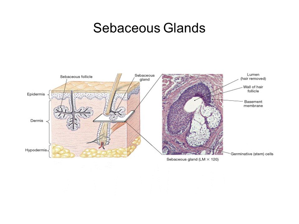 Sebaceous Glands FG04_13A.JPG Title: Sebaceous Glands and Follicles