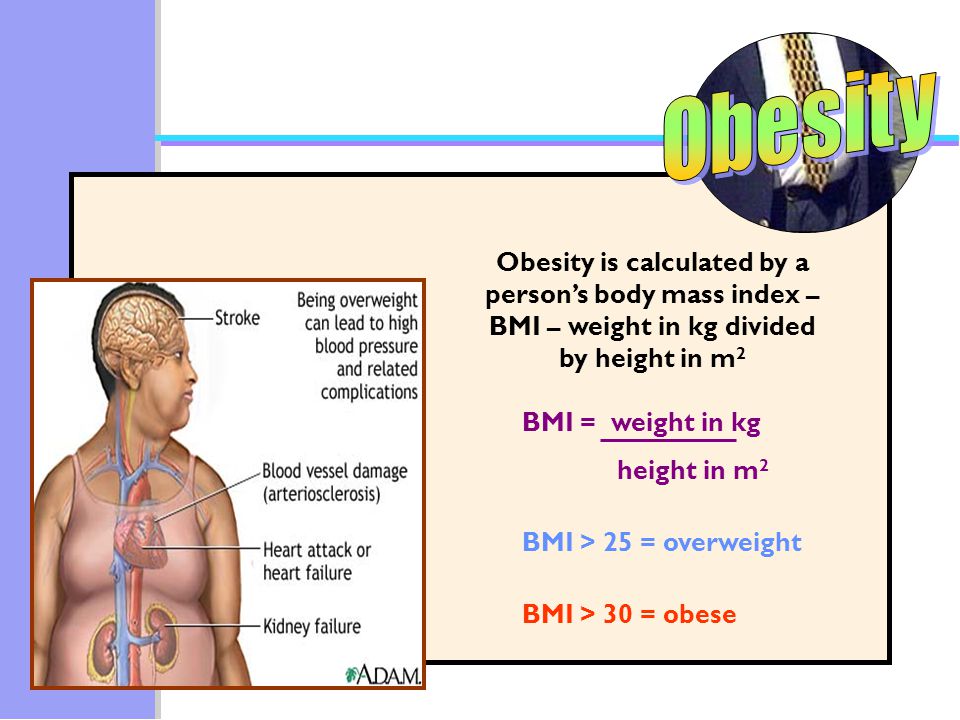 Obesity Obesity is calculated by a person’s body mass index – BMI – weight in kg divided by height in m2.