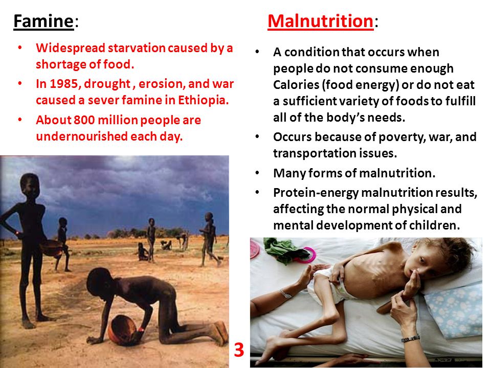 Famine: Malnutrition: