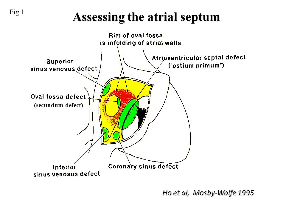 Assessing the atrial septum