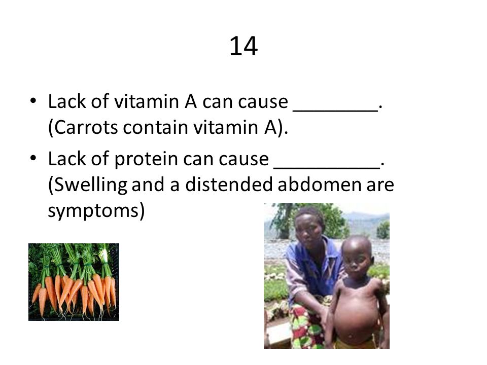 14 Lack of vitamin A can cause ________. (Carrots contain vitamin A).