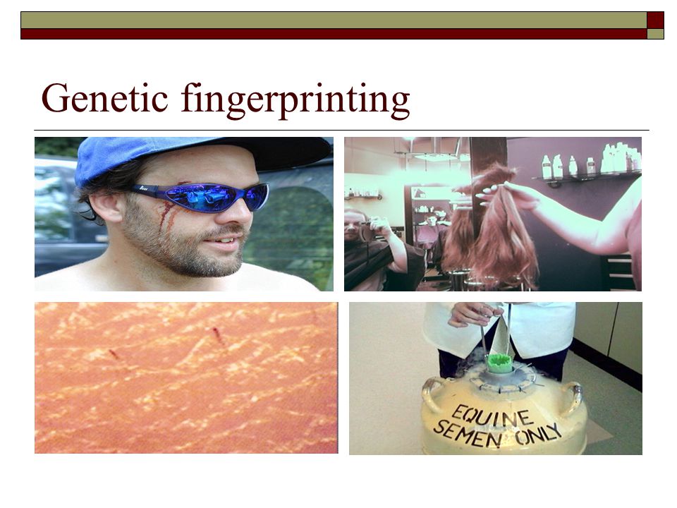 Genetic fingerprinting