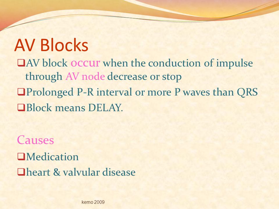 AV Blocks AV block occur when the conduction of impulse through AV node decrease or stop. Prolonged P-R interval or more P waves than QRS.