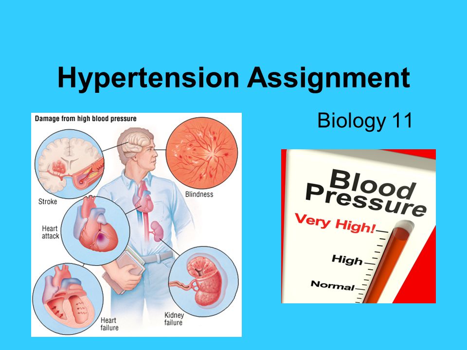 Hypertension Assignment