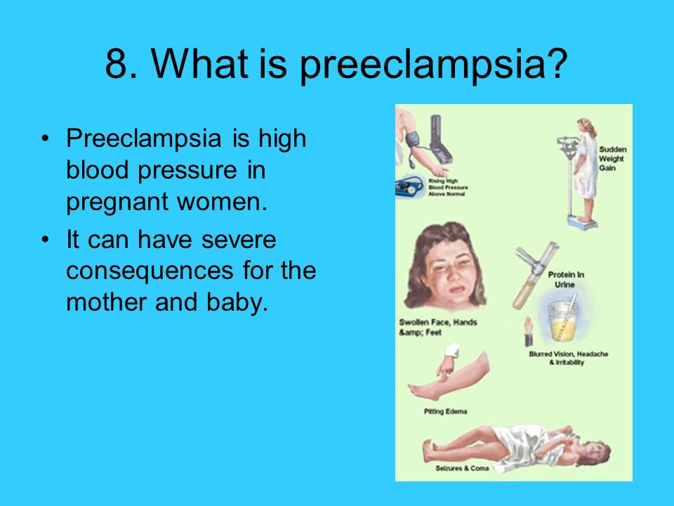 8. What is preeclampsia. Preeclampsia is high blood pressure in pregnant women.