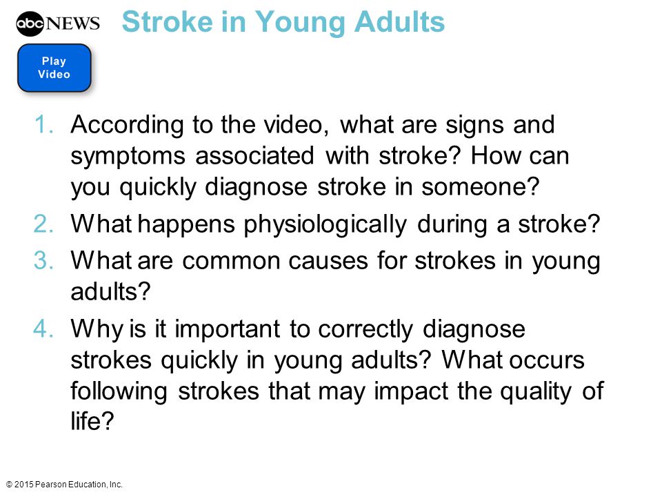 Stroke in Young Adults According to the video, what are signs and symptoms associated with stroke How can you quickly diagnose stroke in someone