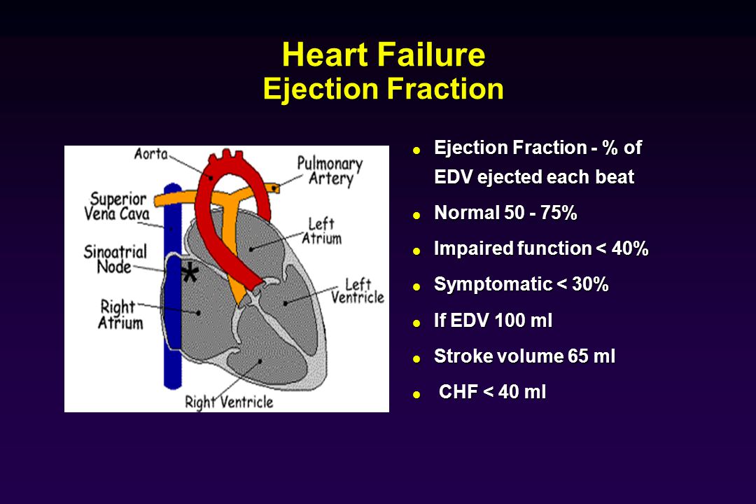Heart Failure Ejection Fraction