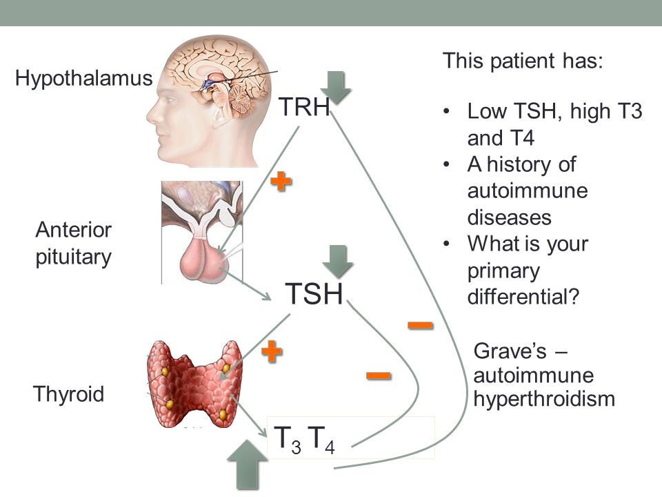 TSH T3 T4 TRH This patient has: Hypothalamus Low TSH, high T3 and T4