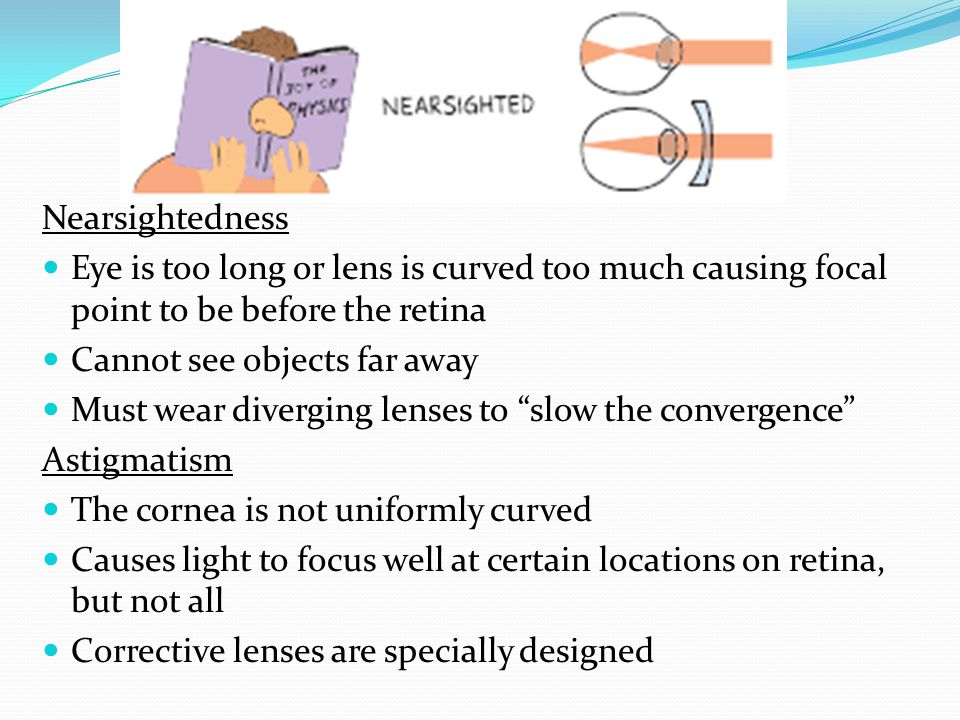 Nearsightedness Eye is too long or lens is curved too much causing focal point to be before the retina.