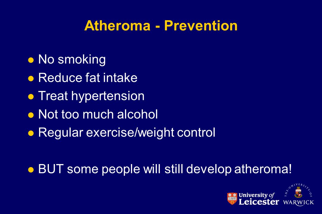 Atheroma - Prevention No smoking Reduce fat intake Treat hypertension