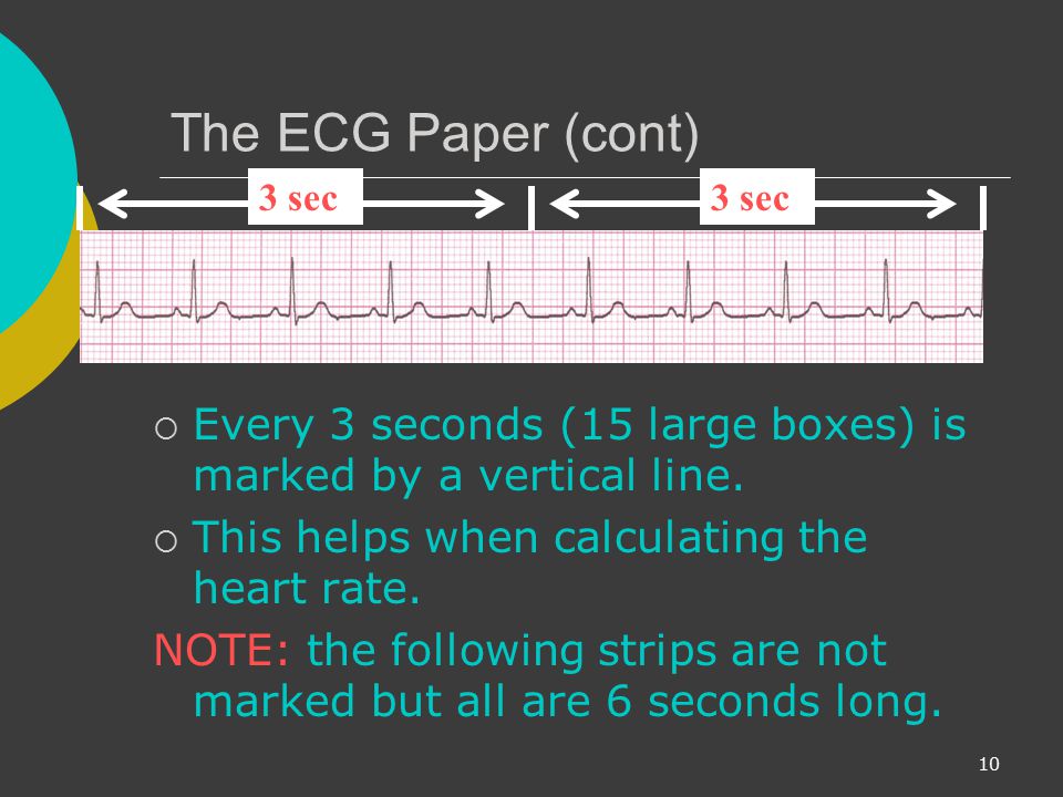 The ECG Paper (cont) 3 sec. 3 sec. Every 3 seconds (15 large boxes) is marked by a vertical line.