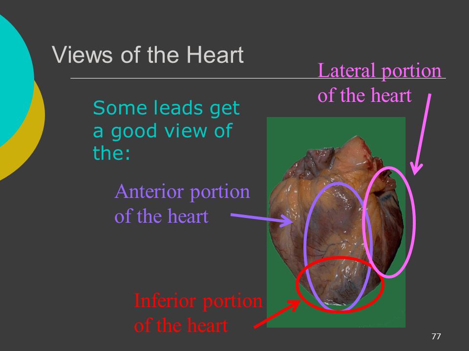 Views of the Heart Lateral portion of the heart