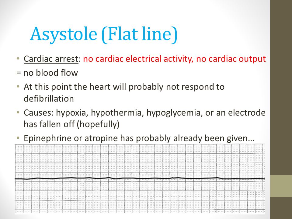 Asystole (Flat line) Cardiac arrest: no cardiac electrical activity, no cardiac output. = no blood flow.