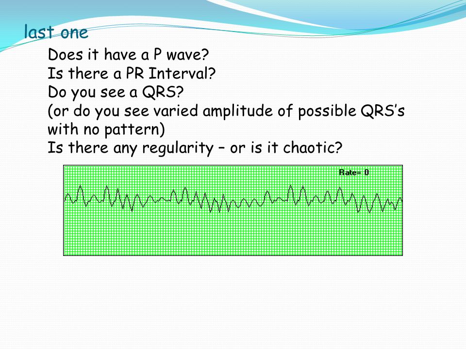 last one Does it have a P wave Is there a PR Interval
