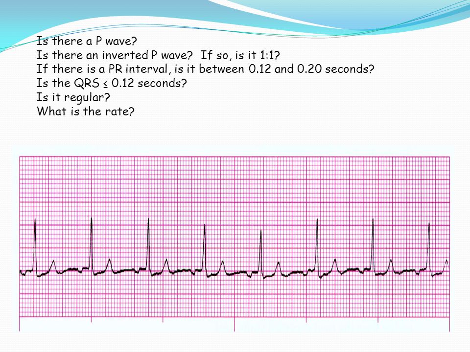 Is there a P wave Is there an inverted P wave If so, is it 1:1 If there is a PR interval, is it between 0.12 and 0.20 seconds
