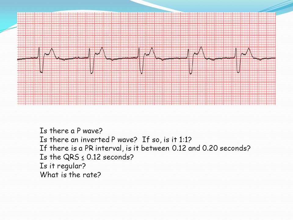 Is there a P wave Is there an inverted P wave If so, is it 1:1 If there is a PR interval, is it between 0.12 and 0.20 seconds