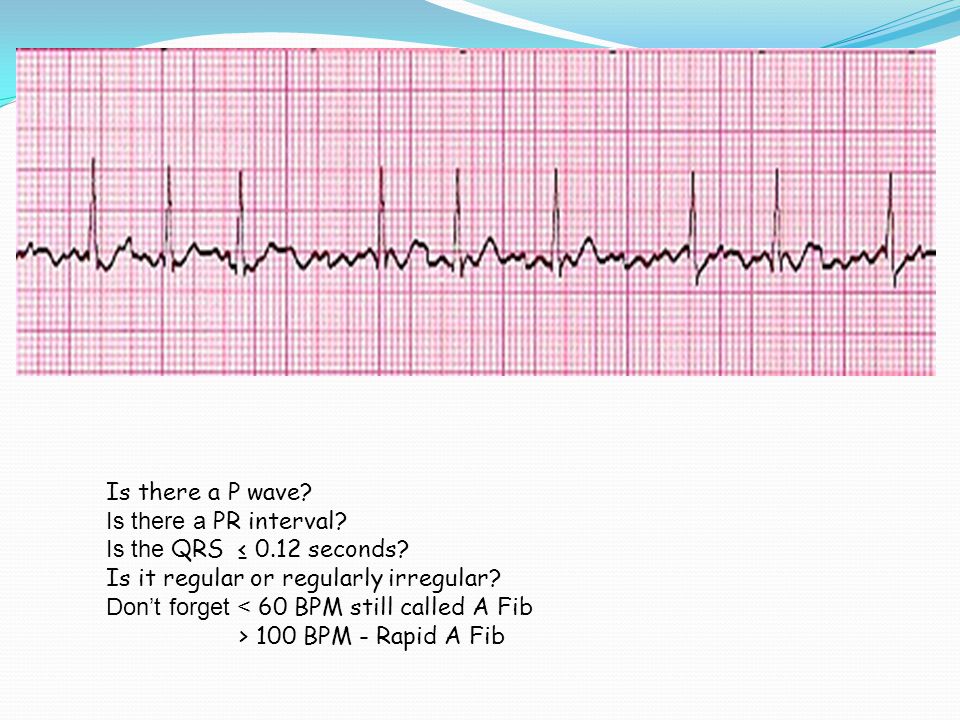 Is there a P wave. Is there a PR interval. Is the QRS ≤ seconds
