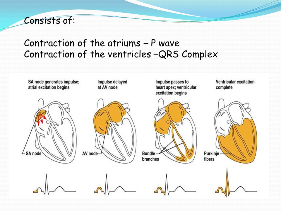 Consists of: Contraction of the atriums – P wave Contraction of the ventricles –QRS Complex