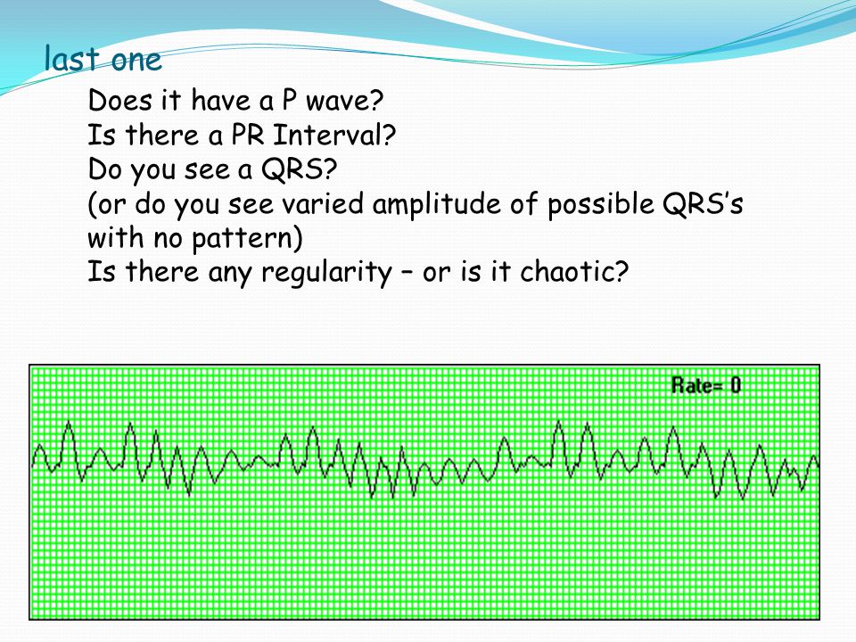 last one Does it have a P wave Is there a PR Interval