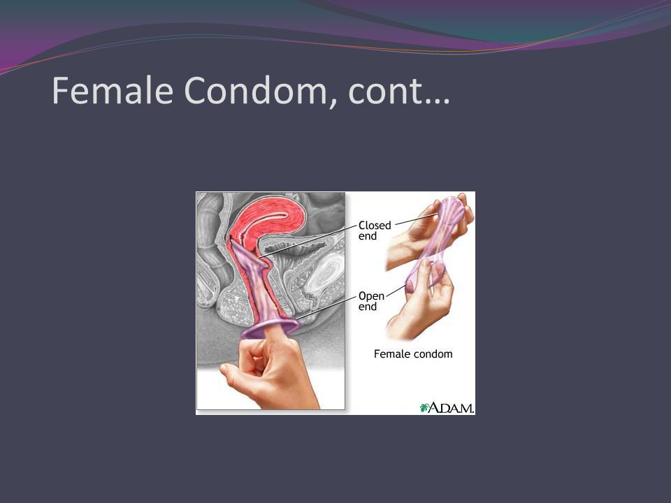 Female Condom, cont…