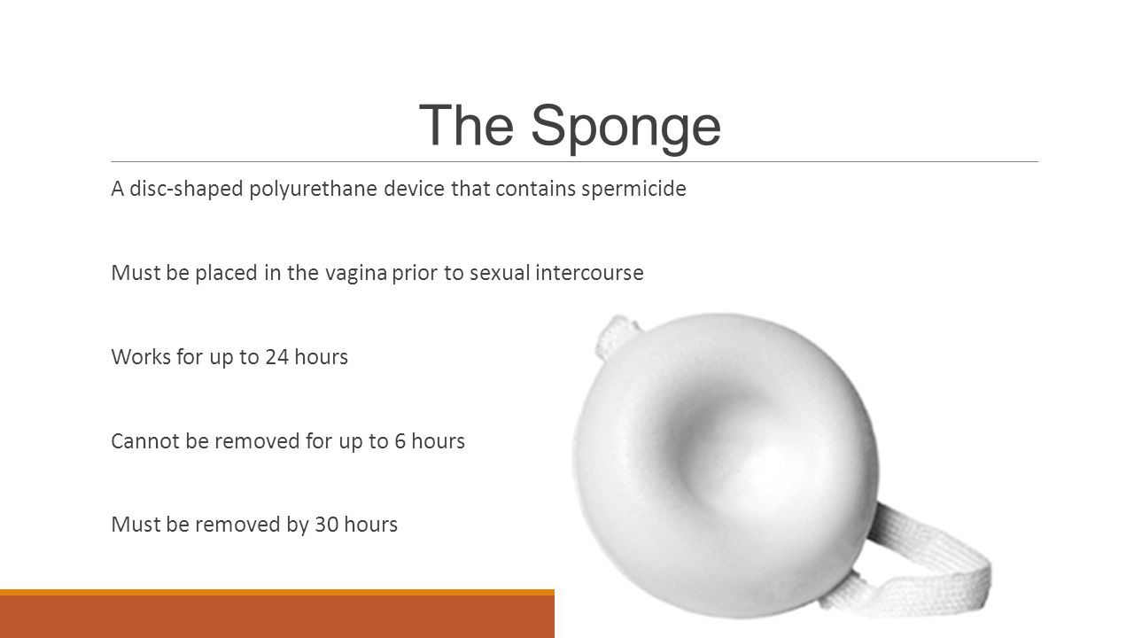 The Sponge A disc-shaped polyurethane device that contains spermicide