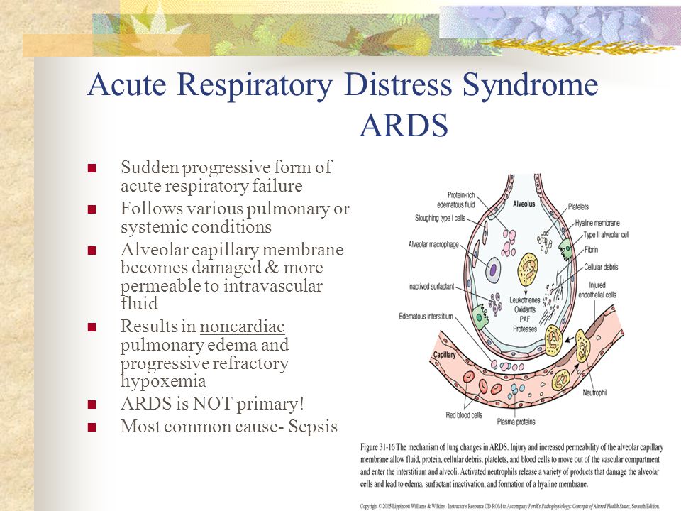 Acute Respiratory Distress Syndrome ARDS
