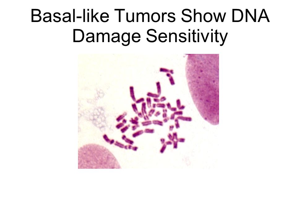 Basal-like Tumors Show DNA Damage Sensitivity