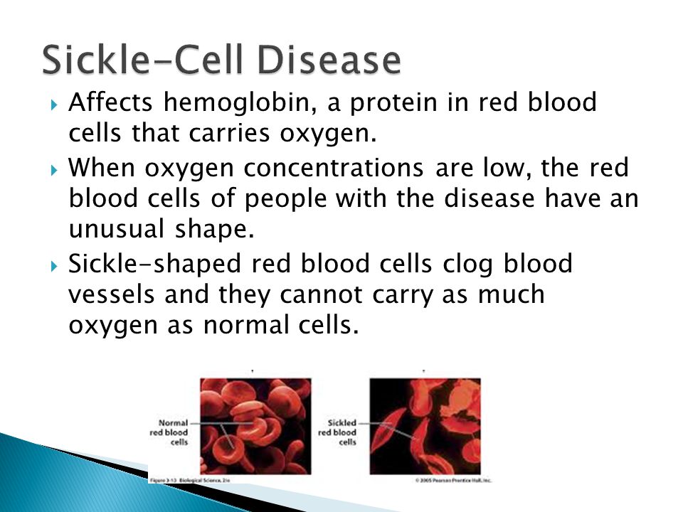 Sickle-Cell Disease Affects hemoglobin, a protein in red blood cells that carries oxygen.