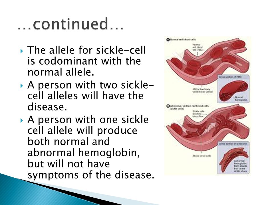 …continued… The allele for sickle-cell is codominant with the normal allele. A person with two sickle- cell alleles will have the disease.