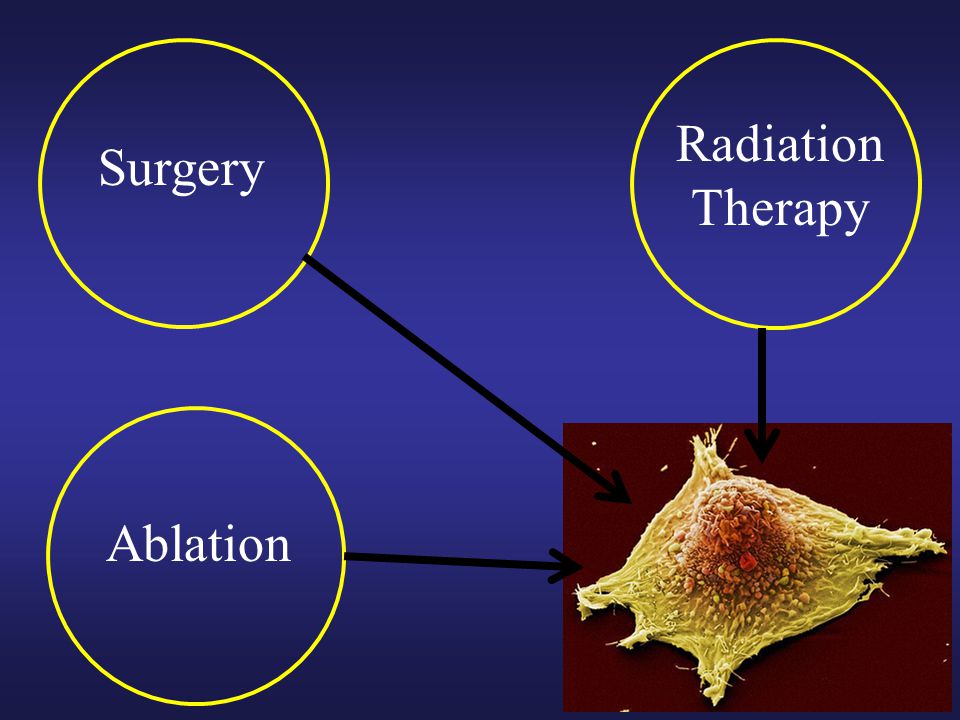 Radiation Therapy Surgery Ablation